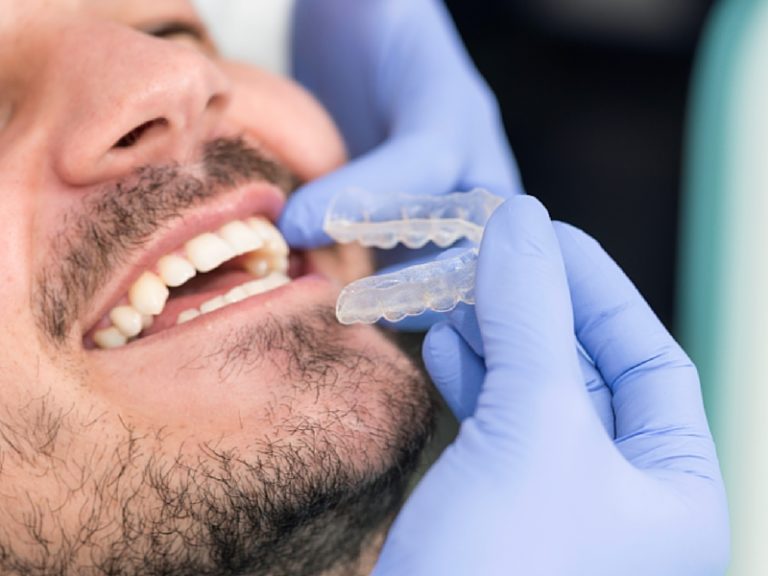 Milton_Orthodontics_Braces_Male_Inserting_Clear_Brace_RetainerFlossing