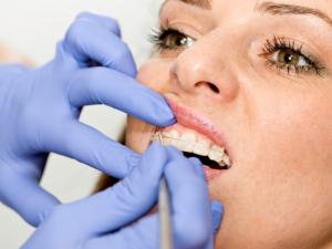 Milton Orthodontics Adult Woman Getting Braces On                                